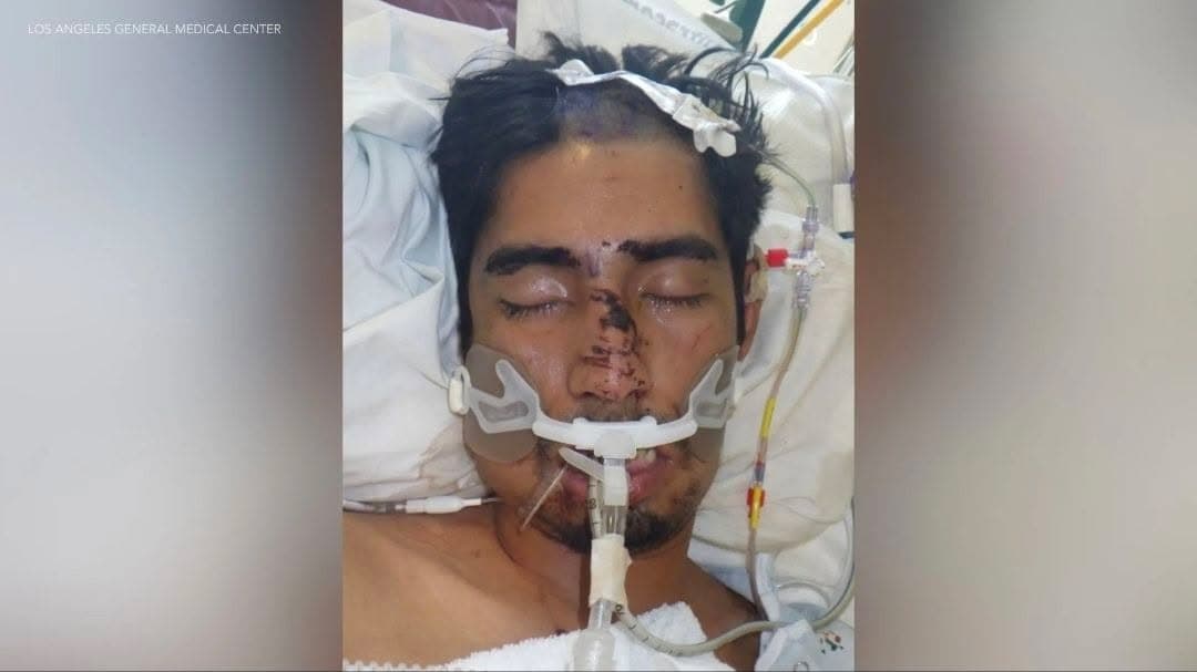 LOS ANGELES COUNTY — Los Angeles General Medical Center is asking for...